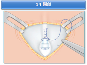 14 閉創