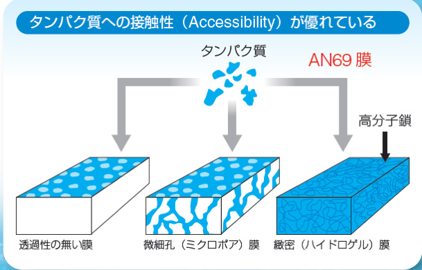 セプザイリス 持続緩徐式血液濾過器 バクスタープロ